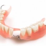 Removable Dentures