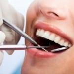 Comprehensive Dental Exams